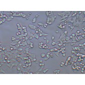 TSINGKE TC‒H0105 HCT-116 人结直肠腺癌细胞