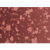 TSINGKE TC‒H0192 Raji 黑人Burkitt淋巴瘤细胞