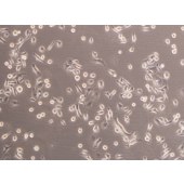 TSINGKE TC‒H0124 TE-1 人食管癌细胞