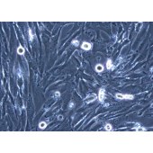 TSINGKE TC‒H0209 HS683 人脑胶质瘤细胞