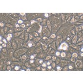 TSINGKE TC‒H0163 C-33A 人宫颈癌细胞