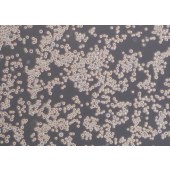 TSINGKE TC‒H0096 KATO III 人胃癌细胞