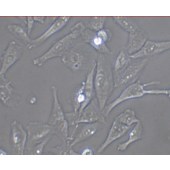 TSINGKE TC‒H0004 SNU-449 人肝癌细胞