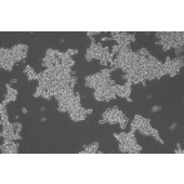 TSINGKE TC‒H0210 WERI-Rb-1 人视网膜神经胶质瘤细胞