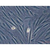 TSINGKE TC‒H0148 JAR 人胎盘绒毛癌细胞