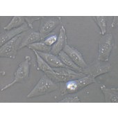 TSINGKE TC‒H0255 SAOS-2 人成骨肉瘤细胞