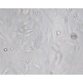 TSINGKE TC‒H0051 SK-Lu-1 人低分化肺腺癌细胞