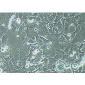 TSINGKE TC‒H0089 HCC1954 人乳腺导管癌细胞