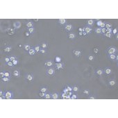 TSINGKE TC‒H0226 Jurkat E6-1 人急性T淋巴细胞白血病细胞