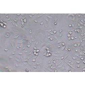 TSINGKE TC‒H0278 CAL-62 人甲状腺癌细胞（退行性）