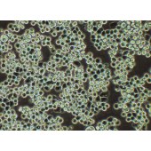 TSINGKE TC‒H0073 MDA-MB-453 人乳腺癌细胞