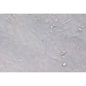 TSINGKE TC‒H0276 B-CPAP 人甲状腺癌细胞（乳头状）