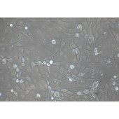 TSINGKE TC‒H0093 SNU-216 人胃癌细胞（淋巴转移）