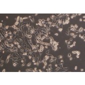 TSINGKE TC‒H0080 BT-549 人乳腺导管癌细胞