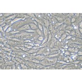 TSINGKE TC‒R0025 SV40 MES 13 小鼠肾小球系膜细胞