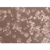 TSINGKE TC‒H0077 ZR-75-30 人乳腺导管癌细胞