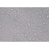 TSINGKE TC‒H0153 SW780 人膀胱移行细胞癌细胞