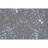 TSINGKE TC‒H0259 RD 人恶性胚胎横纹肌肉瘤细胞