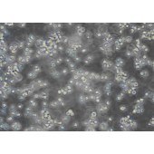 TSINGKE TC‒R0016 Yac-1 小鼠白血病细胞NK细胞靶细胞