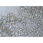 TSINGKE TC‒H0052 NCI-H526 人肺癌转移