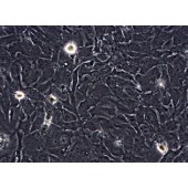 TSINGKE TC‒H0078 HS 578T 人乳腺癌细胞