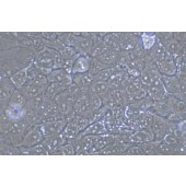 TSINGKE TC‒H0033 HCC827 人非小细胞肺癌细胞