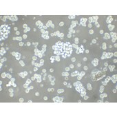 TSINGKE TC‒H0250 NB-4 人急性早幼粒白血病细胞