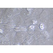 TSINGKE TC‒H0134 SCC-9 人舌鳞癌细胞