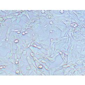 TSINGKE TC‒H0152 UM-UC-3 人膀胱移行细胞癌细胞
