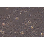 TSINGKE TC‒H0284 SW1990 人胰腺癌细胞（二级腺癌）