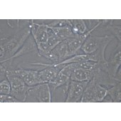 TSINGKE TC‒H0279 KHM-5M 人甲状腺癌细胞（退行性）