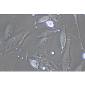 TSINGKE TC‒H0204 U-118 MG 人脑星形胶质母细胞瘤细胞