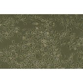 TSINGKE TC‒R0014 B16-F10 小鼠黑色素瘤细胞