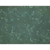 TSINGKE TC‒H0069 SK-BR-3 人乳腺癌细胞