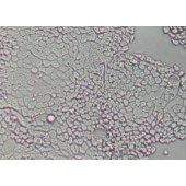 TSINGKE TC‒H0095 NCI-N87 人胃癌细胞