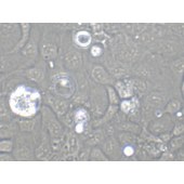 TSINGKE TC‒H0120 SW626 人结肠腺癌细胞(卵巢转移)