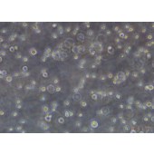 TSINGKE TC‒H0199 CA46 人Burkitt's淋巴瘤细胞