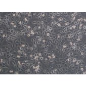 TSINGKE TC‒H0170 HCC94 人子宫鳞癌细胞（高分化）