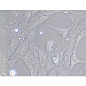 TSINGKE TC‒X0010 RF/6A 猴脉络膜-视网膜(内皮)细胞