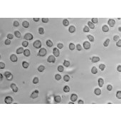 TSINGKE TC‒H0237 RS4;11 人急性淋巴白血病细胞