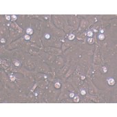 TSINGKE TC‒H0178 PA-1 人卵巢畸胎瘤细胞