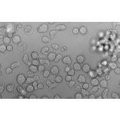 TSINGKE TC‒H0242 Reh 人急性非B非T淋巴细胞白血病细胞