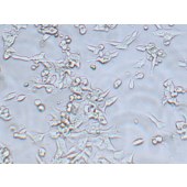 TSINGKE TC‒H0108 LoVo 人结肠癌细胞