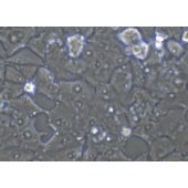 TSINGKE TC‒H0036 NCI-H1395 人肺腺癌细胞