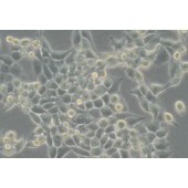 TSINGKE TC‒R0036 LLC 小鼠lewis肺癌细胞