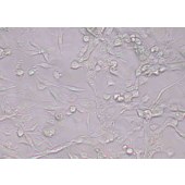 TSINGKE TC‒H0259 RD 人恶性胚胎横纹肌肉瘤细胞