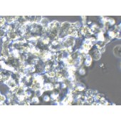 TSINGKE TC‒H0040 NCI-H524 人小细胞肺癌细胞