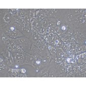 TSINGKE TC‒H0013 Huh-6 人肝母细胞瘤细胞