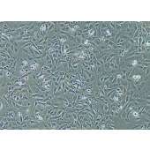 TSINGKE TC‒H0312 Nthy-ori 3-1 人甲状腺滤泡上皮细胞