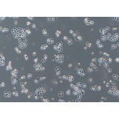 TSINGKE TC‒H0125 Kyse-510 人食管癌细胞